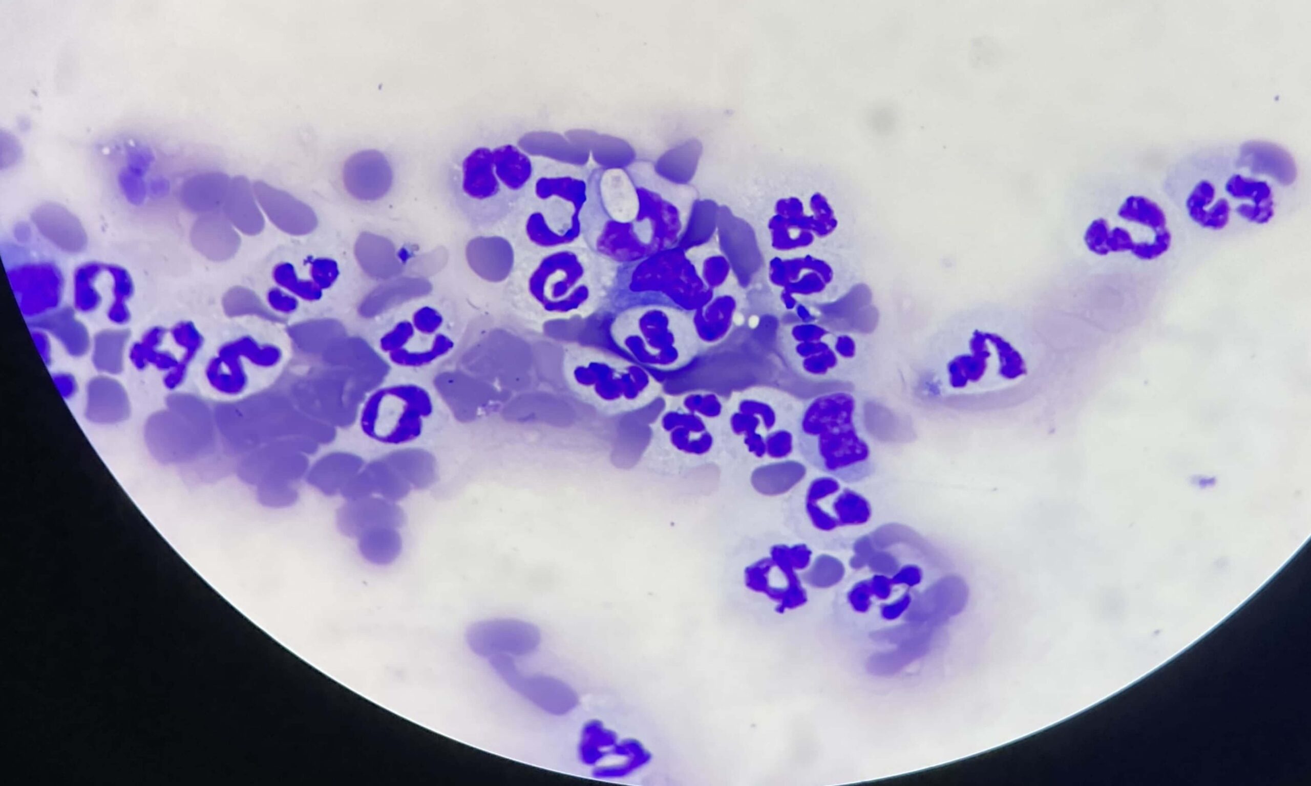 Hepatozoon Tick Fever Biliary in Dogs Ehrlichia Ticks and Fleas KZN Cats and Dogs